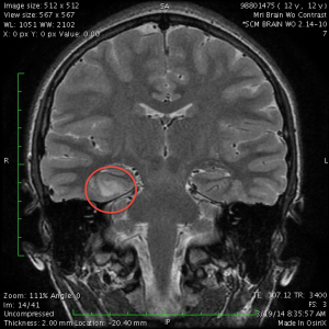 MRI without contrast
